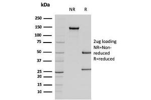 SDS-PAGE Analysis Purified Smooth Muscle Actin Mouse Monoclonal Antibody (SPM322).