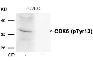 Western blot analysis of extracts from HUVEC cells, treated with calf intestinal phosphatase (CIP), using CDK6 (phospho-Tyr13) Antibody. (CDK6 Antikörper  (pTyr13))