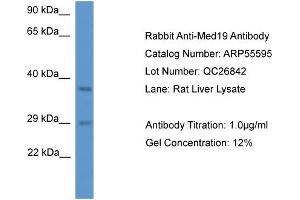 Western Blotting (WB) image for anti-Mediator Complex Subunit 19 (MED19) (N-Term) antibody (ABIN2786281) (MED19 Antikörper  (N-Term))