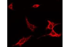 ABIN6275526 staining NIH-3T3 cells by IF/ICC. (SPINK5 Antikörper  (N-Term))