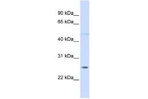 RNF170 antibody used at 1 ug/ml to detect target protein. (RNF170 Antikörper  (C-Term))