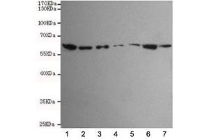 Western blot testing of human 1) HCT116, 2) SW480, 3) HepG2, 4) A549, 5) Jurkat, 6) K562 and 7) HeLa cell lysates using TAB1 antibody at 1:1000. (TAB1 Antikörper)