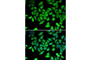 Immunofluorescence analysis of U2OS cells using CCAR2 antibody.