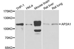 Western blot analysis of extracts of various cell lines, using AP2A1 antibody (ABIN5975765) at 1/1000 dilution. (alpha Adaptin Antikörper)
