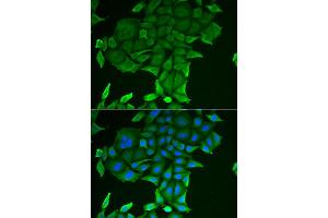 Immunofluorescence analysis of HeLa cell using CD84 antibody. (CD84 Antikörper)