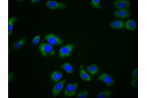 Immunofluorescence staining of A549 cells with ABIN7158892 at 1:166, counter-stained with DAPI. (MPEG1 Antikörper  (AA 537-633))