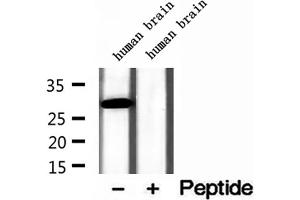 Western blot analysis of extracts of human brain tissue, using GSTA4 antibody. (GSTA4 Antikörper  (N-Term))