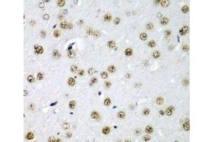 Immunohistochemistry of paraffin-embedded Rat brain using SF3B3 Polyclonal Antibody at dilution of 1:200 (40x lens).