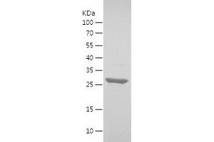 VAMP2 Protein (AA 3-71) (His-IF2DI Tag)