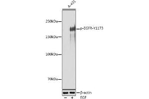 Western blot analysis of extracts of A-431 cells, using Phospho-EGFR-Y1173 antibody (ABIN7266990) at 1:500 dilution.