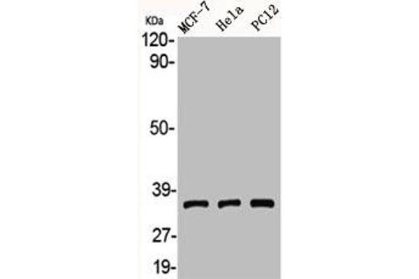 Adenosine A3 Receptor Antikörper  (C-Term)