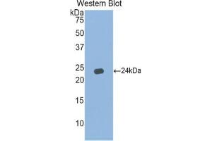 Western blot analysis of the recombinant protein. (IFNA5 Antikörper  (AA 24-189))
