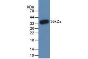 Detection of Recombinant PADI3, Human using Monoclonal Antibody to Peptidyl Arginine Deiminase Type III (PADI3) (PADI3 Antikörper  (AA 1-300))