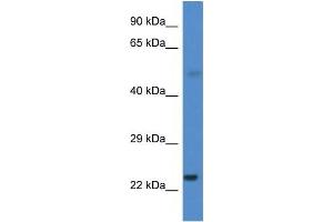 CYP1B1 antibody used at 0. (CYP1B1 Antikörper  (Middle Region))
