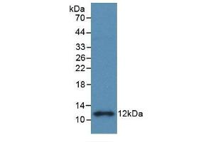 Detection of Recombinant S100B, Rat using Monoclonal Antibody to S100 Calcium Binding Protein B (S100B) (S100B Antikörper  (AA 1-92))
