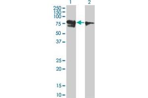 Western Blot analysis of RUNX1T1 expression in transfected 293T cell line by RUNX1T1 monoclonal antibody (M01), clone 5A12. (RUNX1T1 Antikörper  (AA 416-525))