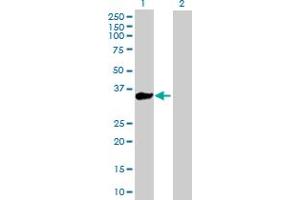 Western Blot analysis of KLHL3 expression in transfected 293T cell line by KLHL3 MaxPab polyclonal antibody. (KLHL3 Antikörper  (AA 1-301))