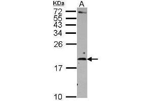 WB Image Sample (30 ug of whole cell lysate) A: Raji 15% SDS PAGE antibody diluted at 1:500 (IL-2 Antikörper)