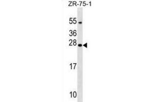 Western Blotting (WB) image for anti-Nucleoredoxin Like Protein 1 (NXNL1) antibody (ABIN2999692) (NXNL1 Antikörper)