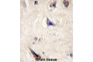 Immunohistochemistry (IHC) image for anti-Leucine-Rich Repeat Containing G Protein-Coupled Receptor 5 (LGR5) (Loop 1) antibody (ABIN3001605) (LGR5 Antikörper  (Loop 1))