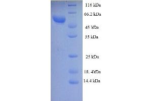 SDS-PAGE (SDS) image for Zona Pellucida Glycoprotein 3 (ZP3) (AA 23-346), (partial) protein (GST tag) (ABIN5712926)