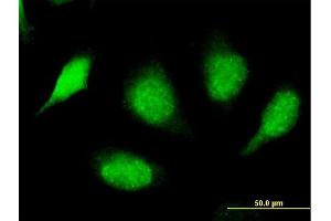 Immunofluorescence of purified MaxPab antibody to SPSB3 on HeLa cell.