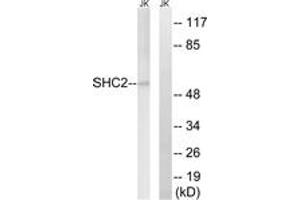 Western blot analysis of extracts from Jurkat cells, using SHC2 Antibody. (SHC2 Antikörper  (AA 261-310))