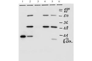 IP analysis of HPV-18 E7 protein. (HPV18 E7 Antikörper  (AA 1-35))