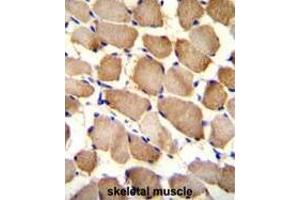 ARL17P1 Antibody (Center) immunohistochemistry analysis in formalin fixed and paraffin embedded human skeletal muscle followed by peroxidase conjugation of the secondary antibody and DAB staining. (ARL17A Antikörper  (Middle Region))
