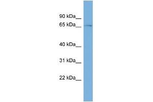 WB Suggested Anti-ZNF697 Antibody Titration:  0.