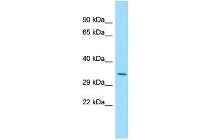 Western Blotting (WB) image for anti-Oligodendrocyte Lineage Transcription Factor 2 (OLIG2) (C-Term) antibody (ABIN2777566)