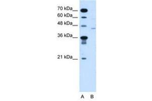 Image no. 1 for anti-Fukutin (FKTN) (AA 111-160) antibody (ABIN205072) (Fukutin Antikörper  (AA 111-160))