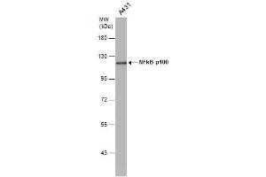 WB Image NFkB p100 antibody [C2C3], C-term detects NFkB p100 protein by western blot analysis. (NFKB2 Antikörper  (C-Term))