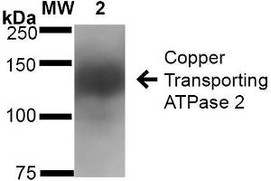 Western Blot analysis of Rat Brain Membrane showing detection of ~160 kDa Copper Transporting ATPase 2 protein using Mouse Anti-Copper Transporting ATPase 2 Monoclonal Antibody, Clone S62-29 . (ATP7B Antikörper  (AA 3-21) (Atto 488))