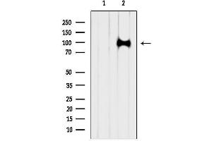 anti-Glutamate Receptor, Metabotropic 6 (GRM6) (C-Term) antibody