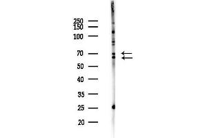 anti-Cdk5 and Abl Enzyme Substrate 1 (CABLES1) (C-Term) antibody