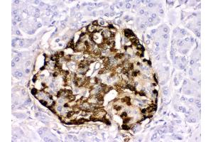 Anti- GLP1 Picoband antibody, IHC(P) IHC(P): Human Pancreatic Cancer Tissue (Glucagon Antikörper  (N-Term))