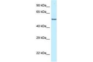 Image no. 1 for anti-Zinc Finger Protein 384 (ZNF384) (C-Term) antibody (ABIN6747728) (ZNF384 Antikörper  (C-Term))