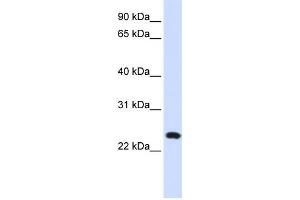 Western Blotting (WB) image for anti-Lysosomal-Associated Membrane Protein Family, Member 5 (LAMP5) antibody (ABIN2459056) (LAMP5 Antikörper)