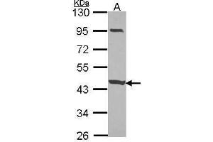 WB Image Sample (30 ug of whole cell lysate) A: JurKat 10% SDS PAGE CCDC83 antibody antibody diluted at 1:1000 (CCDC83 Antikörper)