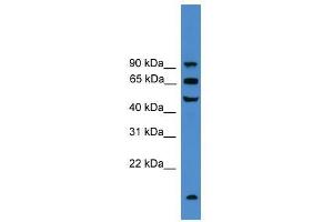 UMOD antibody used at 0. (Uromodulin Antikörper  (C-Term))