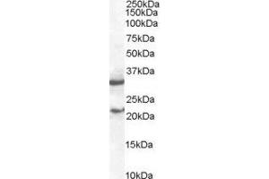 ABIN2560058 staining (2µg/ml) of mouse spleen lysate (RIPA buffer, 35µg total protein per lane). (SOCS1 Antikörper  (C-Term))