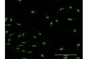Immunofluorescence of purified MaxPab antibody to KIAA0020 on HeLa cell. (KIAA0020 Antikörper  (AA 1-648))