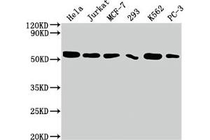 Western Blot Positive WB detected in: Hela whole cell lysate, Jurkat whole cell lysate, MCF-7 whole cell lysate, 293 whole cell lysate, K562 whole cell lysate, PC-3 whole cell lysate All lanes: CDC37 antibody at 1:2000 Secondary Goat polyclonal to rabbit IgG at 1/50000 dilution Predicted band size: 45 kDa Observed band size: 50 kDa (Rekombinanter CDC37 Antikörper)