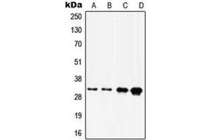 Western blot analysis of HOXD8 expression in A375 (A), A431 (B), HepG2 (C), HeLa (D) whole cell lysates. (HOXD8 Antikörper  (C-Term))