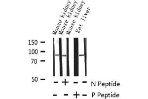 Western blot analysis of Phospho-Catenin beta (Tyr489)expression in various lysates (CTNNB1 Antikörper  (pTyr489))