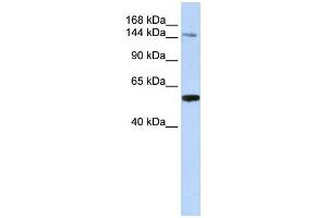 EDC4 antibody used at 1 ug/ml to detect target protein. (EDC4 Antikörper  (N-Term))