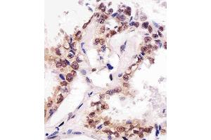 Immunohistochemistry (Paraffin-embedded Sections) (IHC (p)) image for anti-Small Ubiquitin Related Modifier Protein 1 (SUMO1) antibody (ABIN4914409)