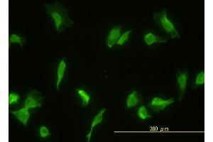 Immunofluorescence (IF) image for anti-Glomulin, FKBP Associated Protein (GLMN) (AA 1-594) antibody (ABIN564837)