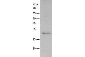 MMP13 Protein (AA 104-274) (His tag)